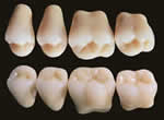 False teeth - a product of Ivoclar Vivadent